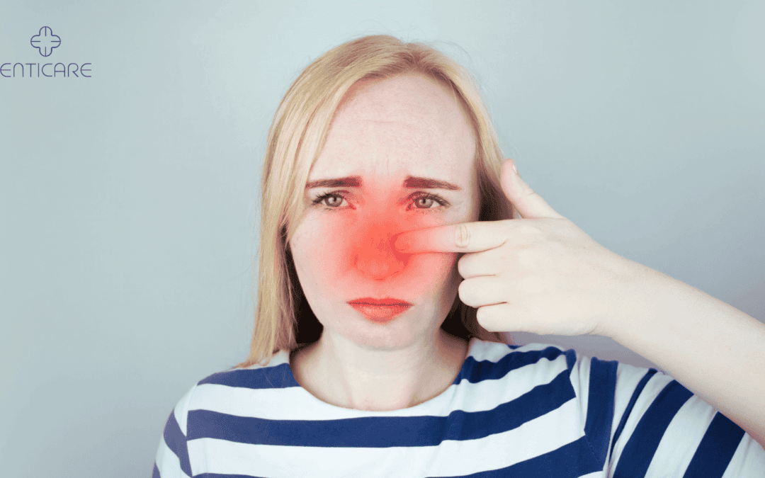 Sinusitis Symptoms and Treatment | Causes, Remedies & Relief