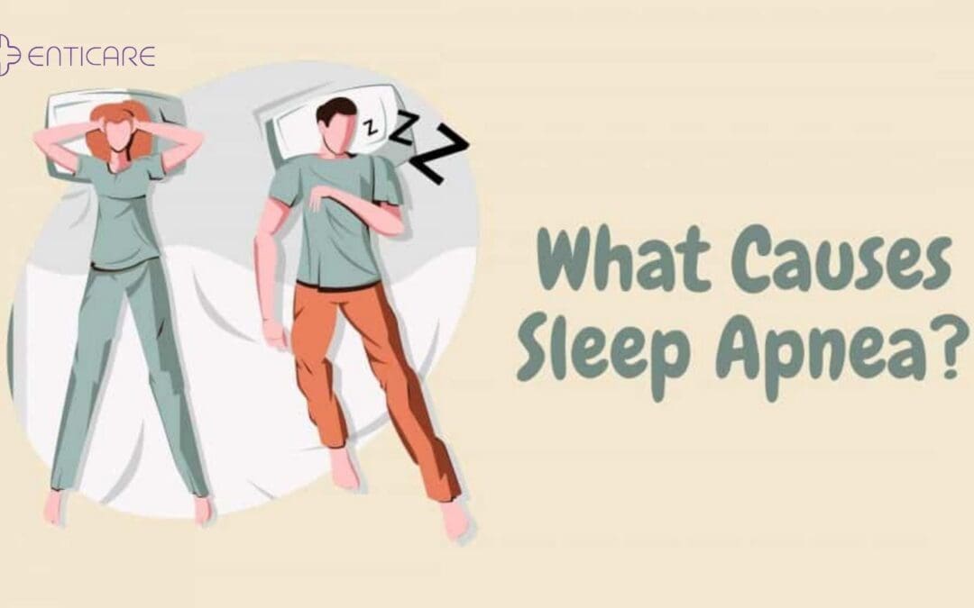 What Can Cause Sleep Apnea?