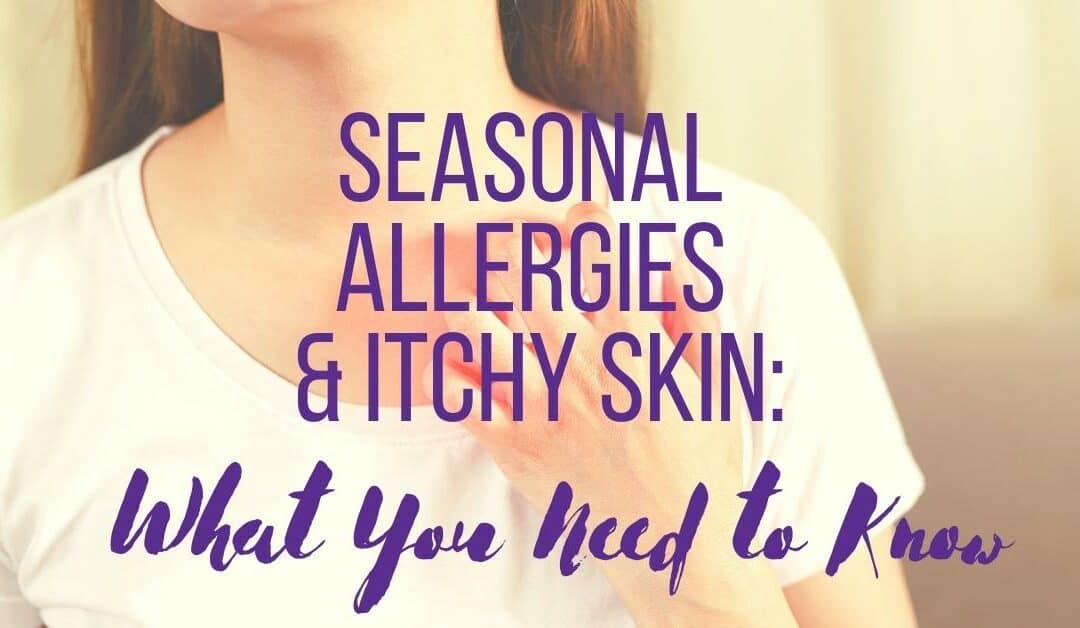 can seasonal allergies cause itchy skin