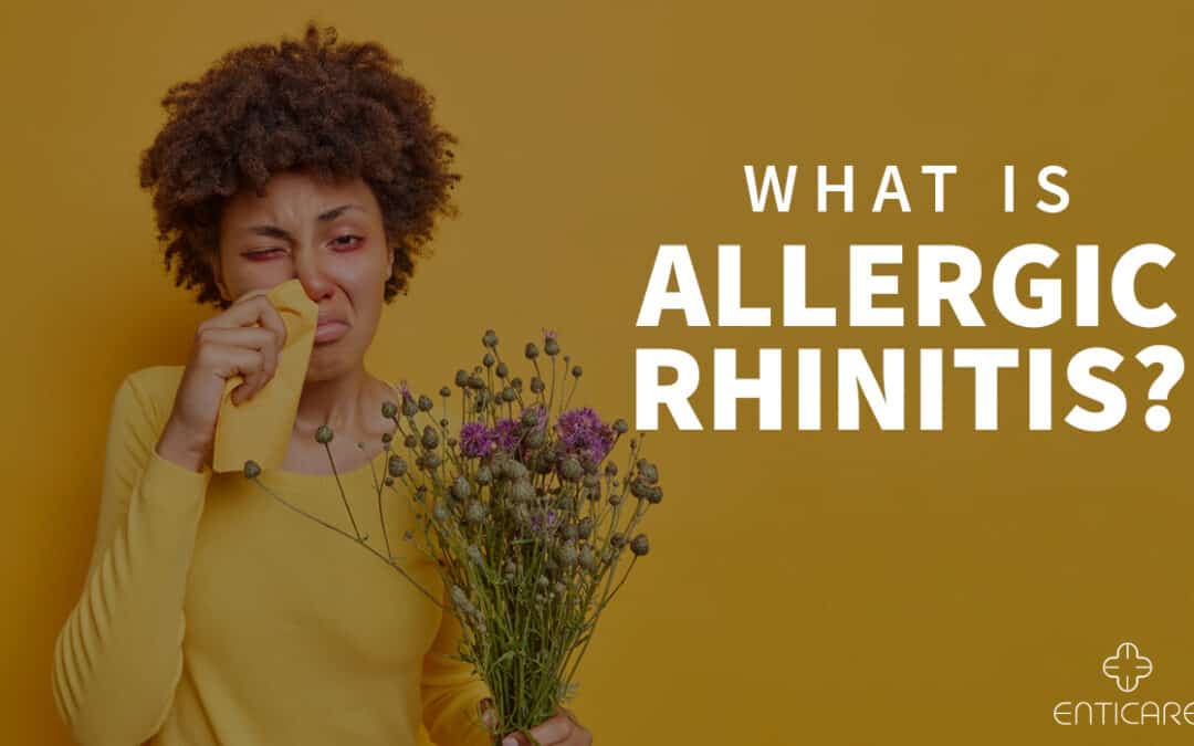 What is Allergic Rhinitis?