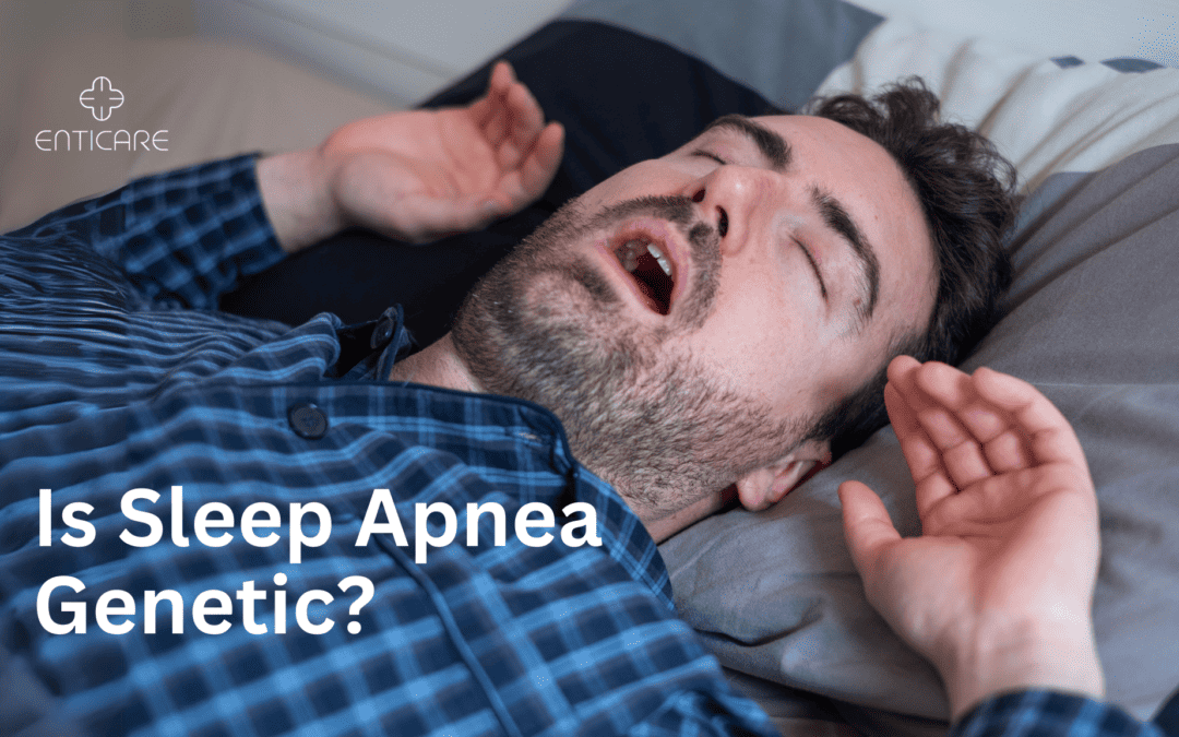 Is Sleep Apnea Genetic?