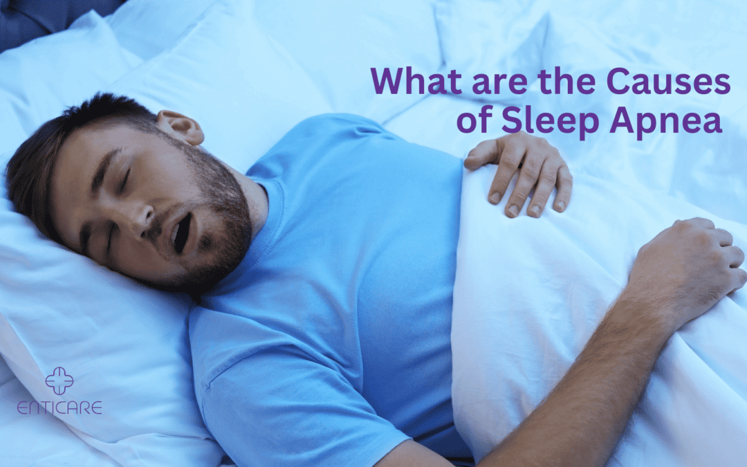 What are the Causes of Sleep Apnea