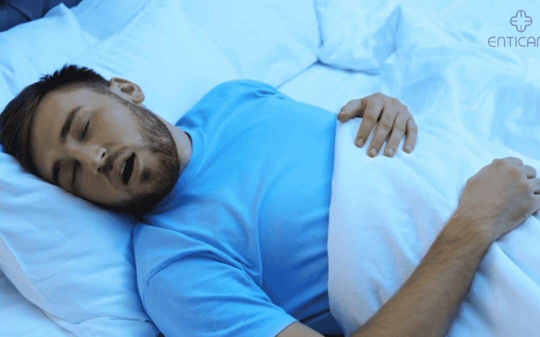 sleep apnea