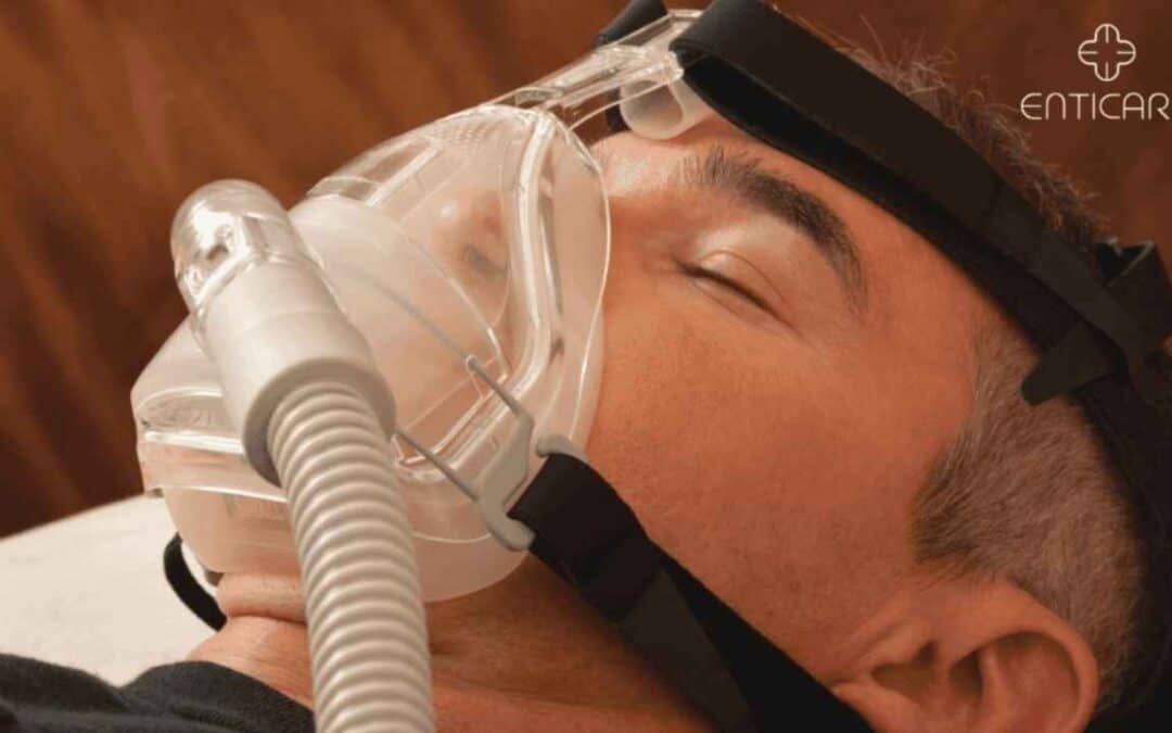Should You Keep Your Mouth Closed with a Nasal CPAP Mask?