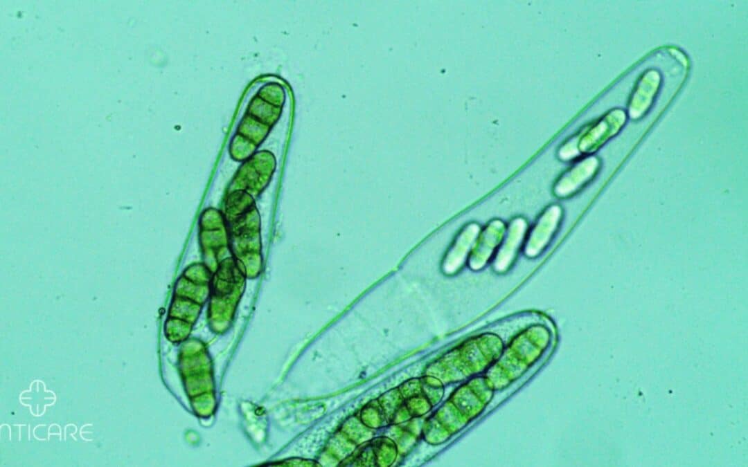 Breathe Easy: Conquering Helminthosporium Mold Allergy