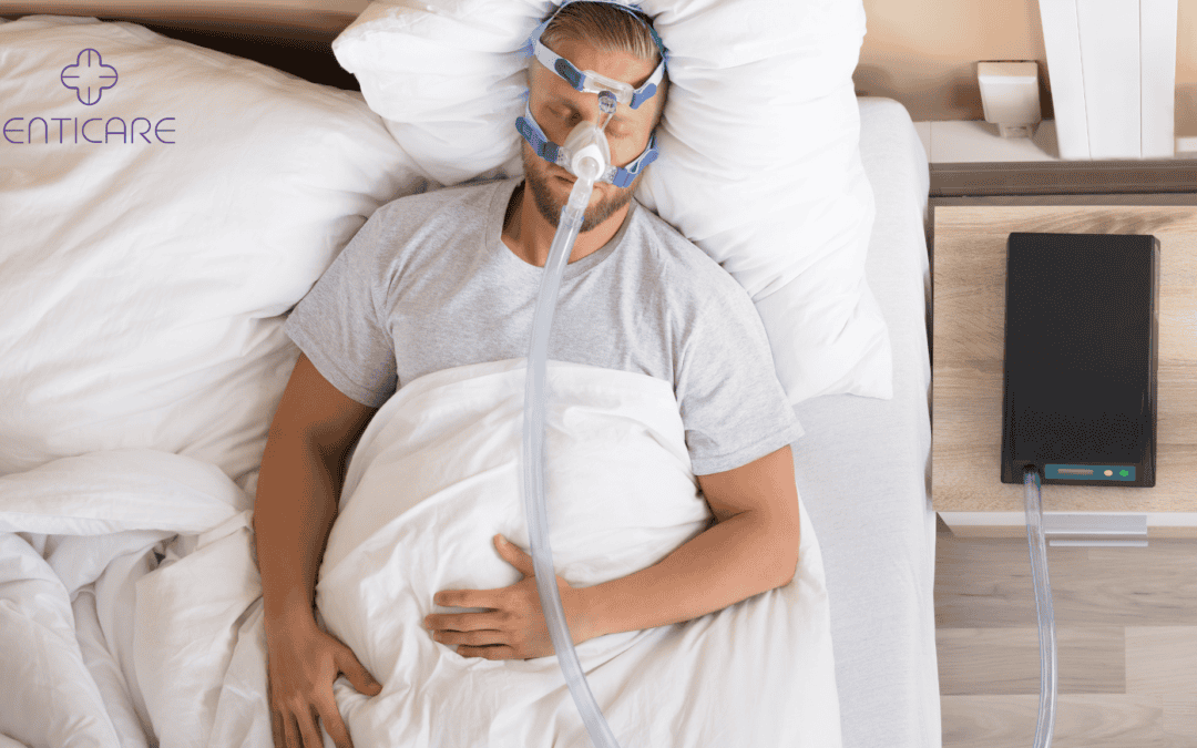 How Does Department of Transportation Monitor CPAP Usage?