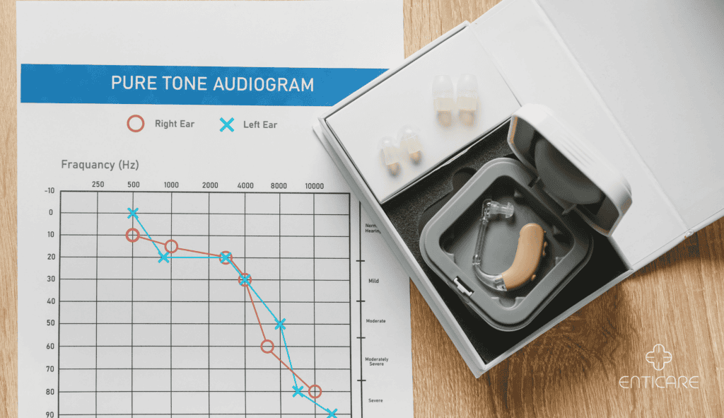 enticare-hearing-aid-audiogram