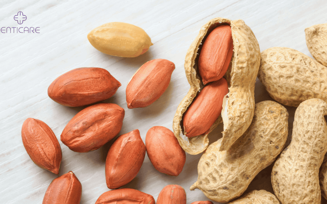 Peanut Allergy 101: Symptoms, Diagnosis & Safe Eating Tips