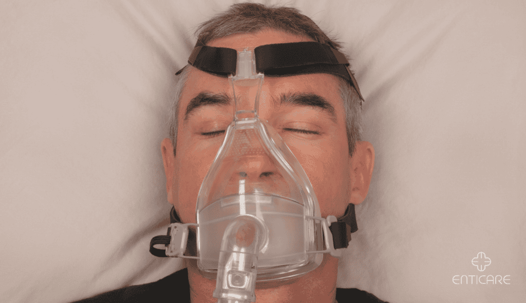 enticare-sleep-apnea-min