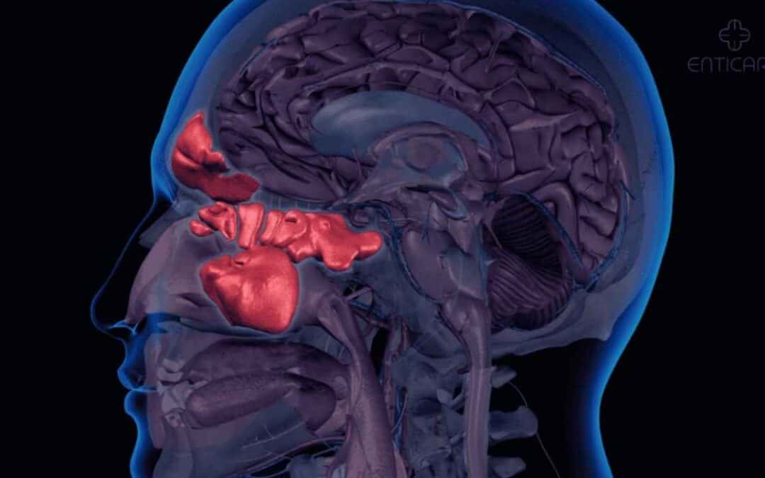 What Causes Sinuses Ringing in Ears? Symptoms & Treatment