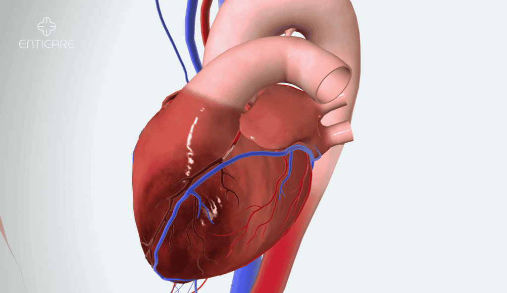 enticare-angina