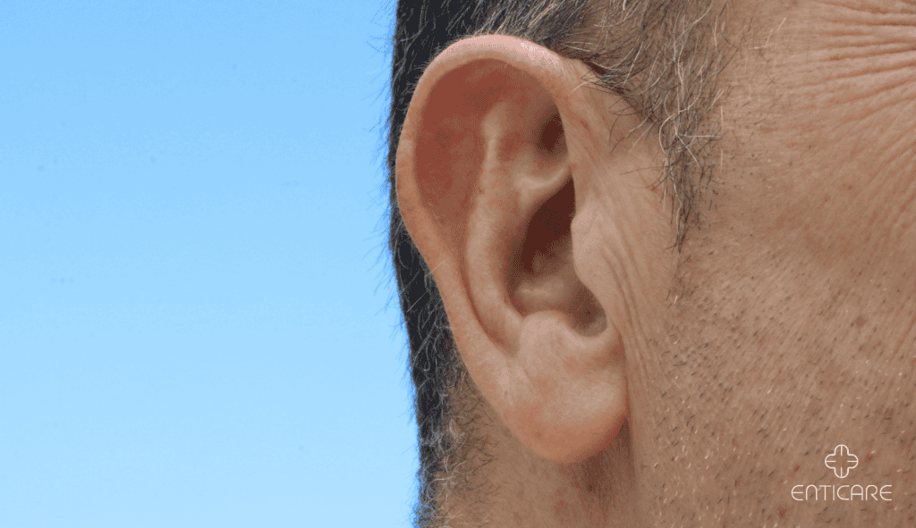 enticare-side-ear