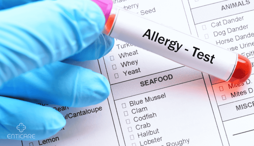 enticare-allergy-test