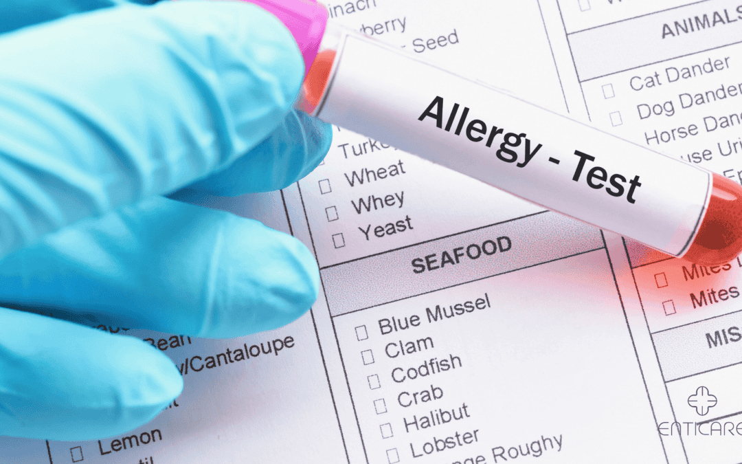 The Best Types of Allergy Testing: Find the Right Solution for You