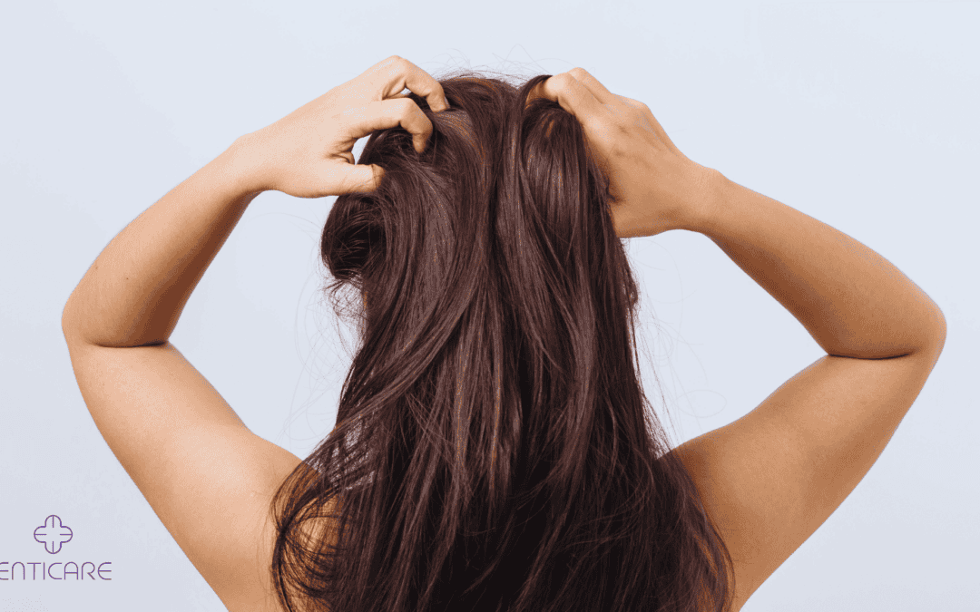 Can Allergies Cause Itchy Scalp? Causes, Symptoms & Relief