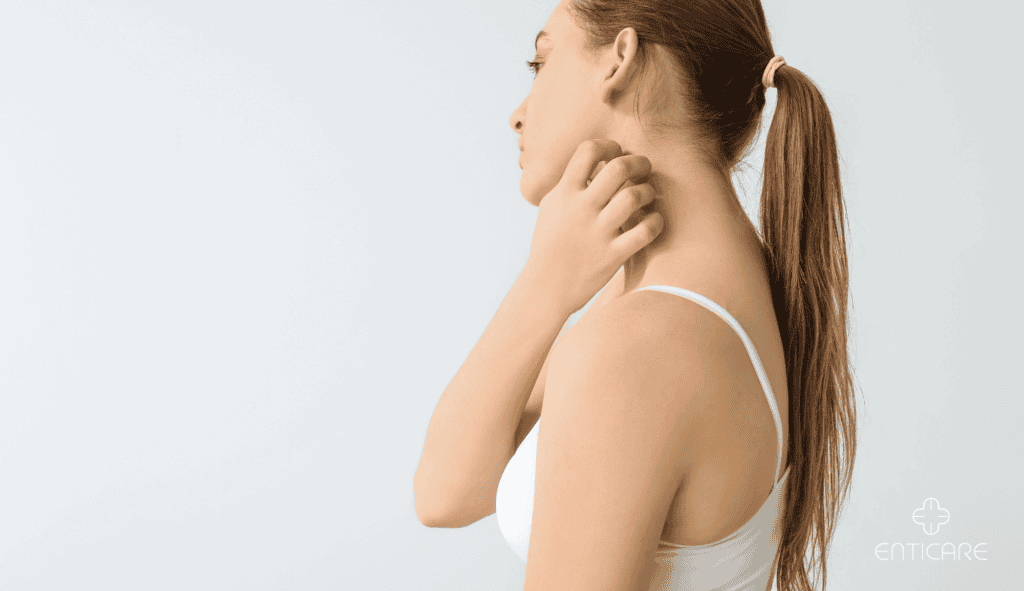 enticare-neck-skin-allergy