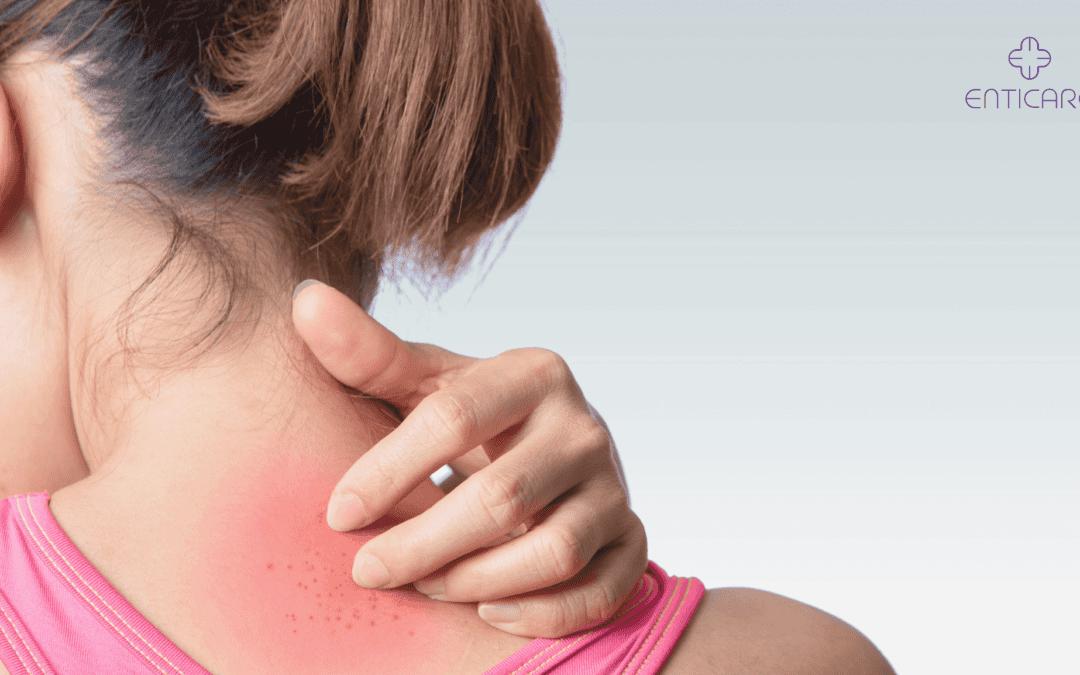 What’s That Skin Rash on Your Neck?