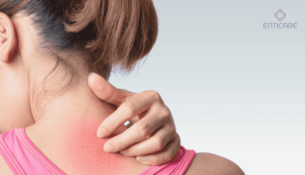 What’s That Skin Rash on Your Neck?