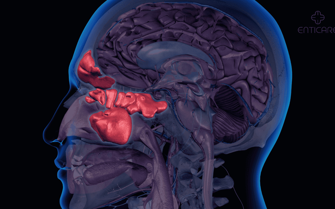 What Causes Sinuses Ringing in Ears? Symptoms & Treatment