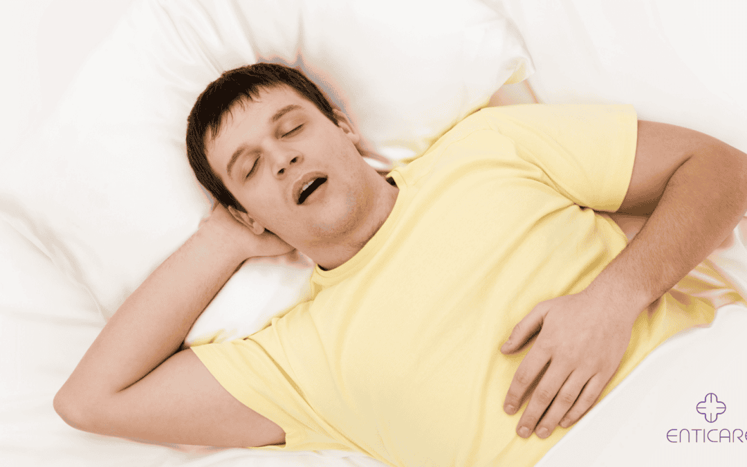 Do I Have Sleep Apnea? Quiz to Uncover the Silent Threat to Your Health