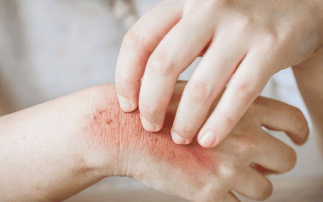 Understanding the Immune System and Allergy: Key Insights and Facts