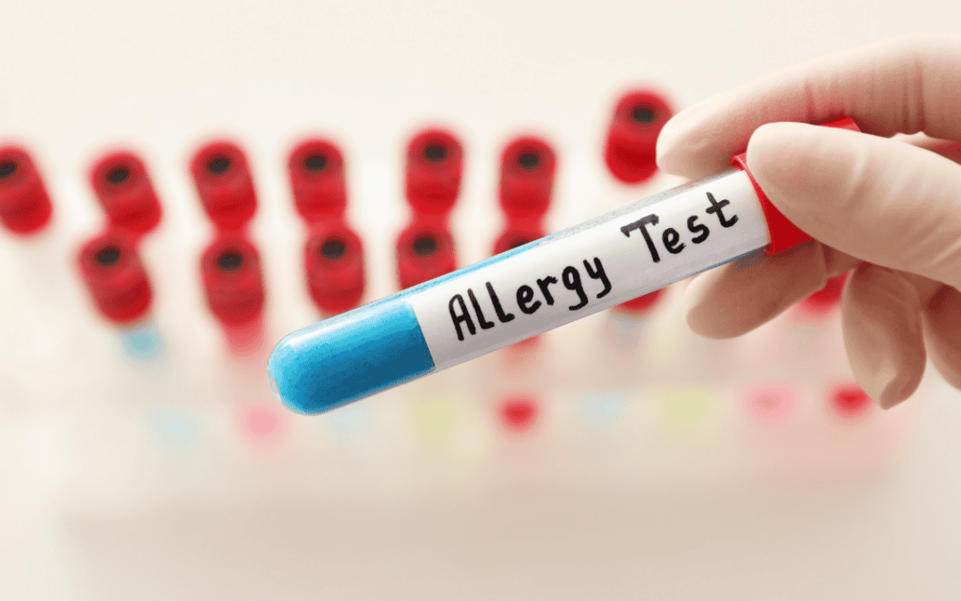 Understanding the Environmental Allergy Test: A Complete Guide to Identifying Your Allergens